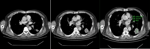 静脉期.png 静脉期.png